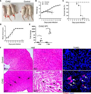 Analysis of miRNAs Involved in Mouse Heart Injury Upon Coxsackievirus A2 Infection